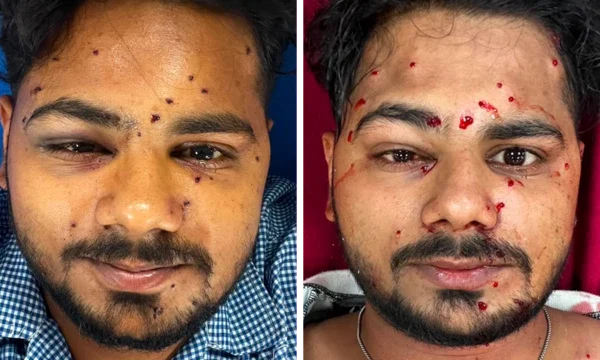 दिल्लीमा जेनजीलाई प्रतिबन्धित हतियारबाट दमन, विपक्षीले…