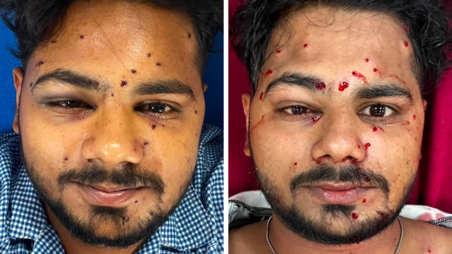 दिल्लीमा जेनजीलाई प्रतिबन्धित हतियारबाट दमन, विपक्षीले उठाइरहेछन् प्रश्न